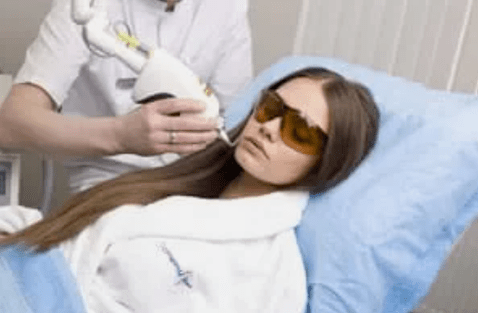 odmładzanie laserem frakcyjnym